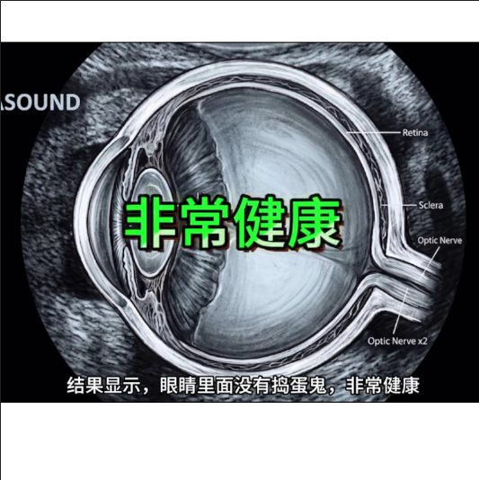 眼睛无虫子.png
