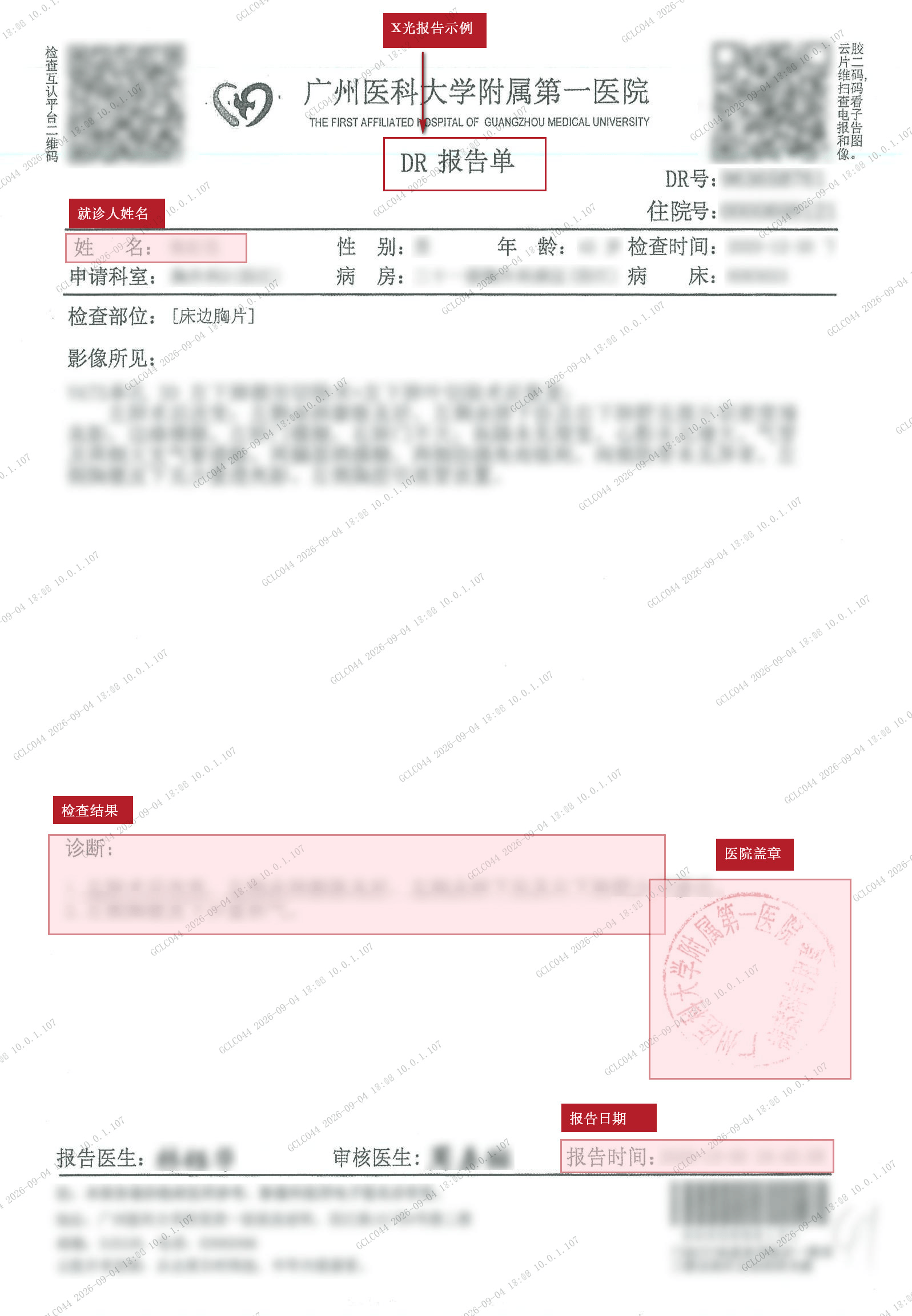 一般性检查 X光报告（粉色）.jpg