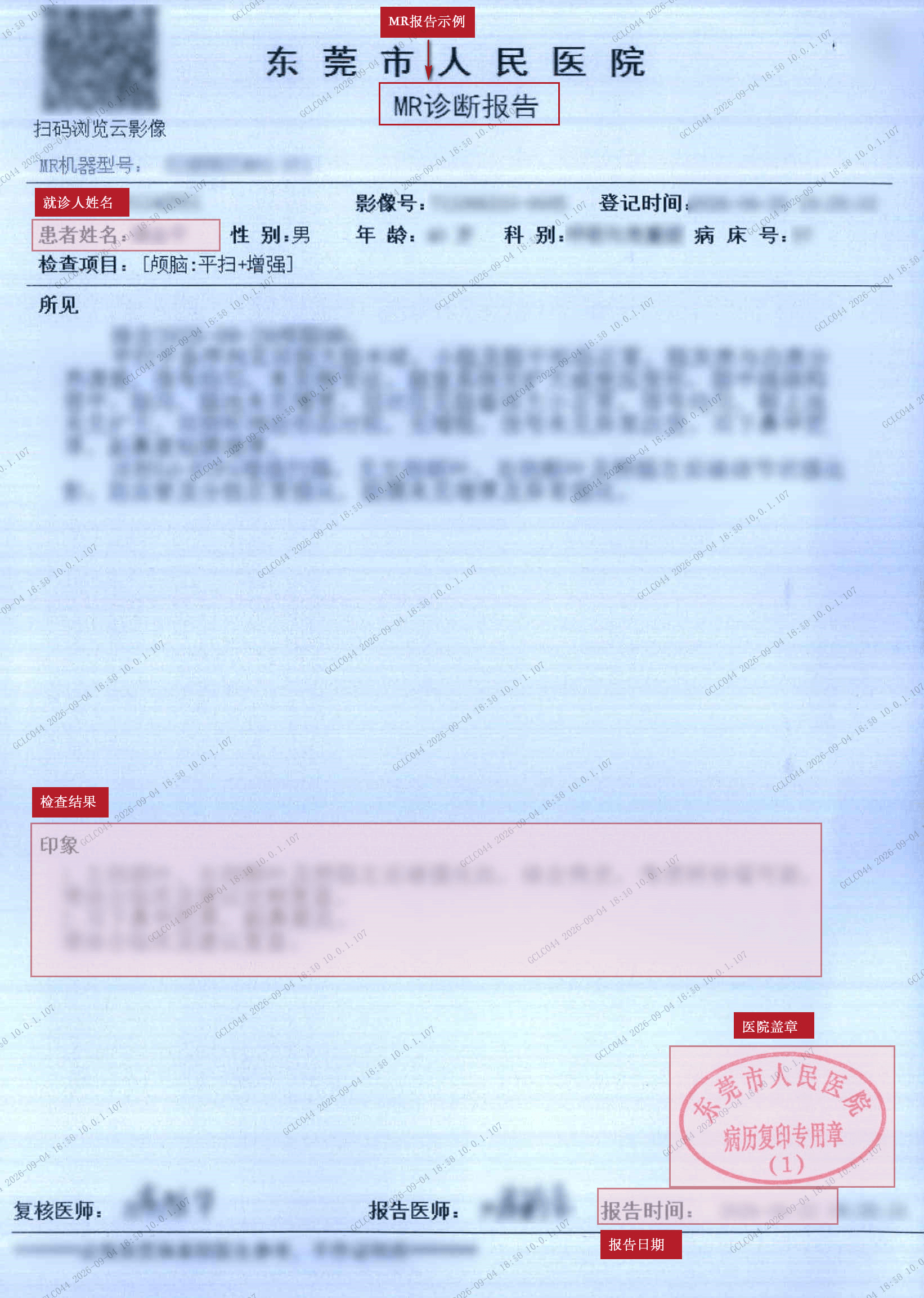 一般性检查 MR报告（粉色）.jpg