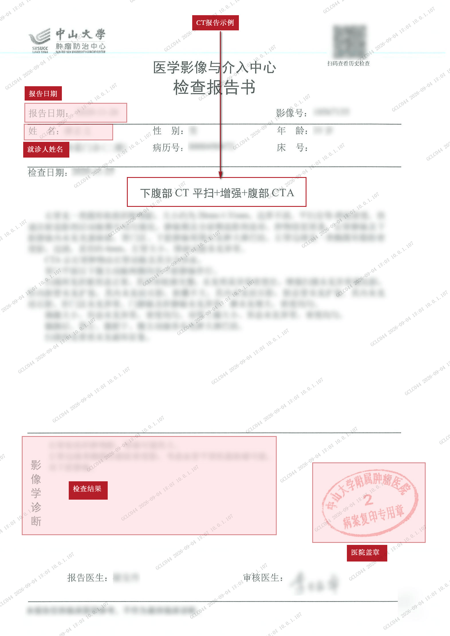 一般性检查 CT报告（粉色）.jpg