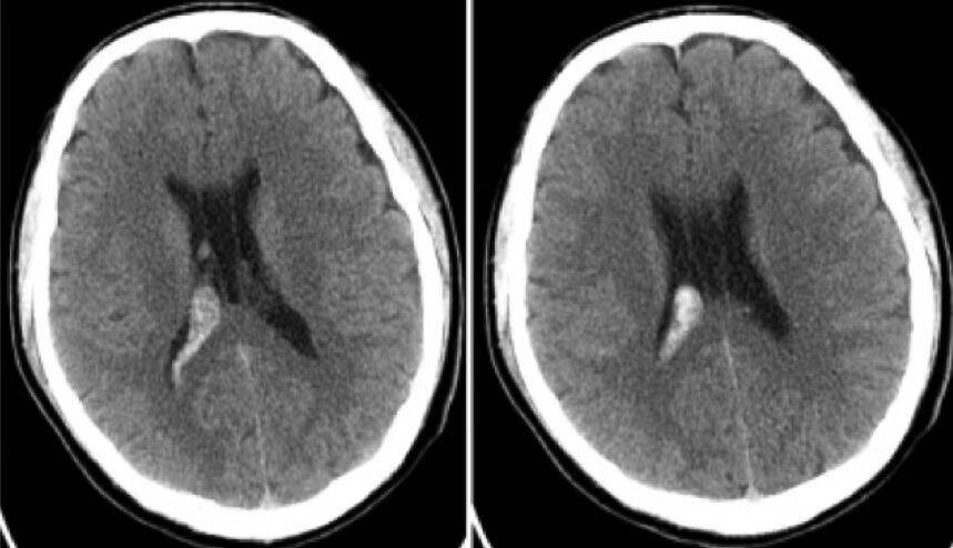 请输入图片描述 请输入图片描述