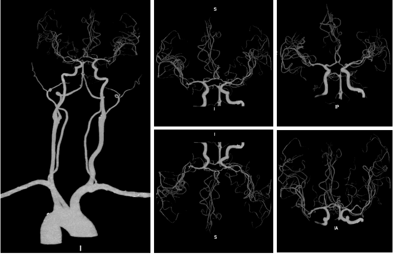 请输入图片描述 请输入图片描述