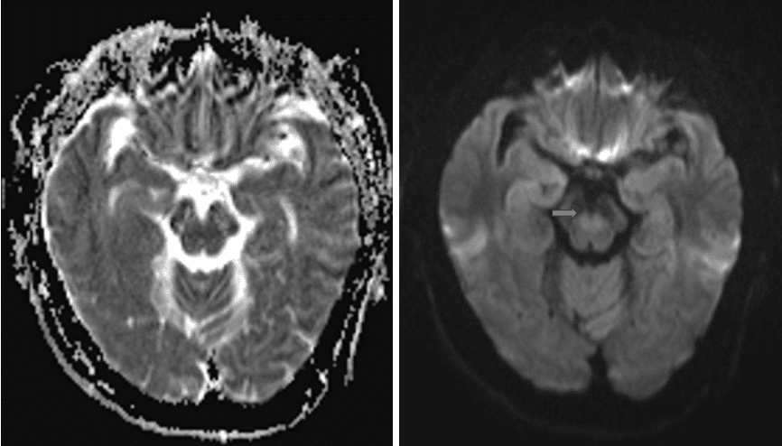 请输入图片描述