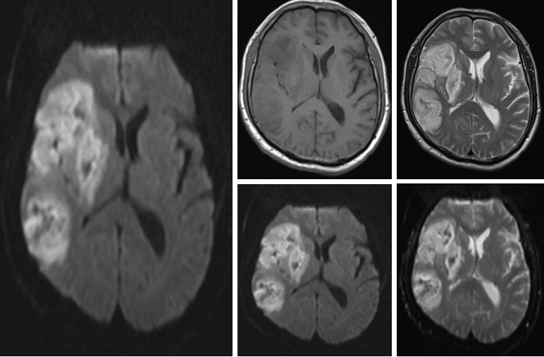 请输入图片描述 请输入图片描述