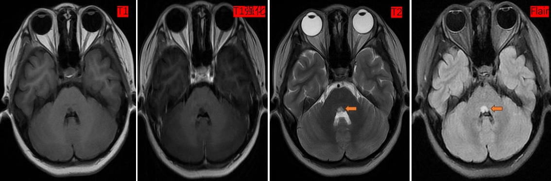 请输入图片描述 请输入图片描述