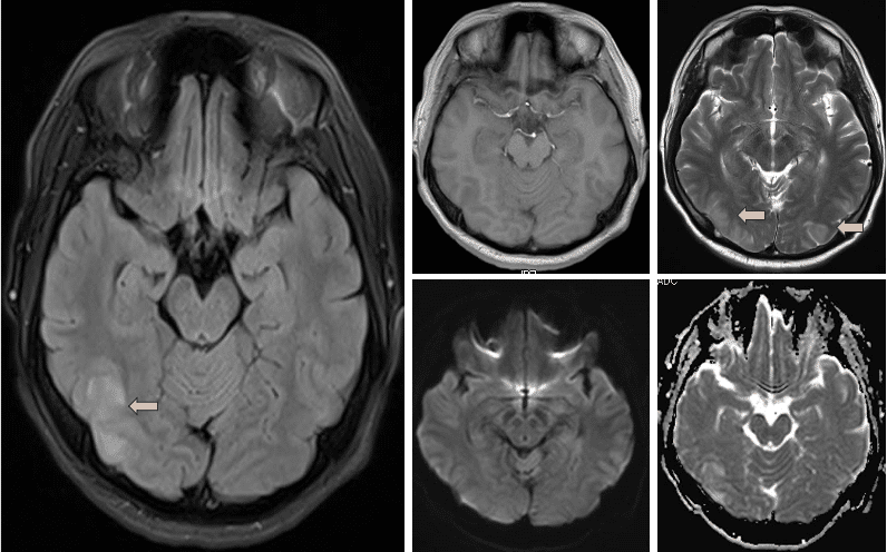 请输入图片描述 请输入图片描述