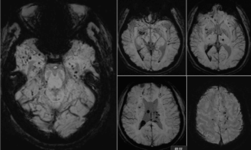 请输入图片描述 请输入图片描述