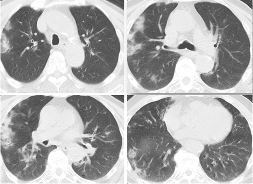 请输入图片描述 请输入图片描述