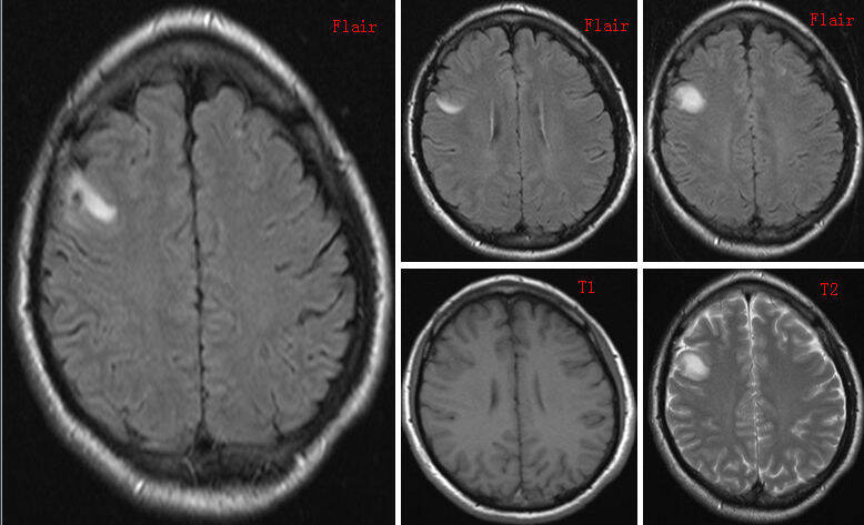 请输入图片描述 请输入图片描述