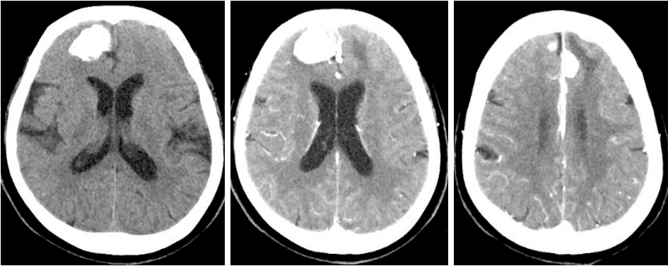 请输入图片描述
