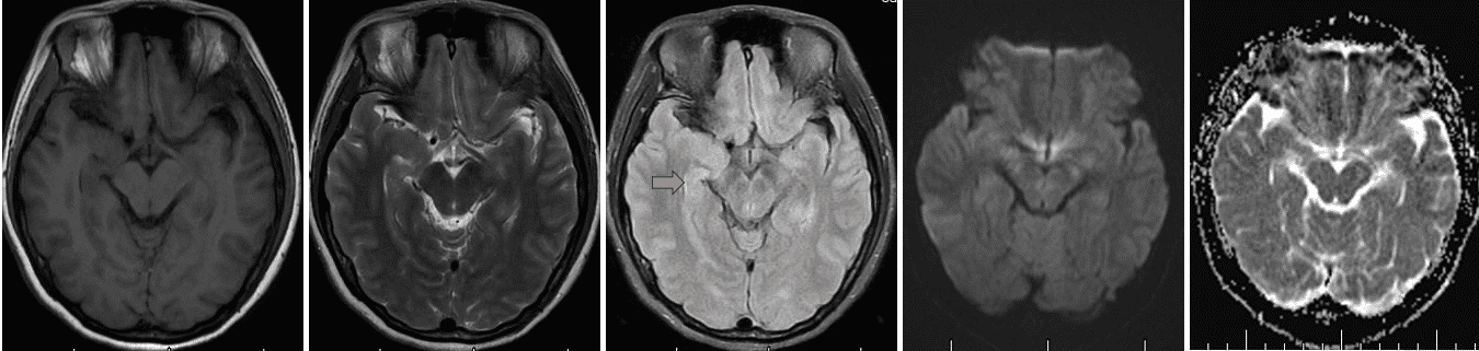 请输入图片描述